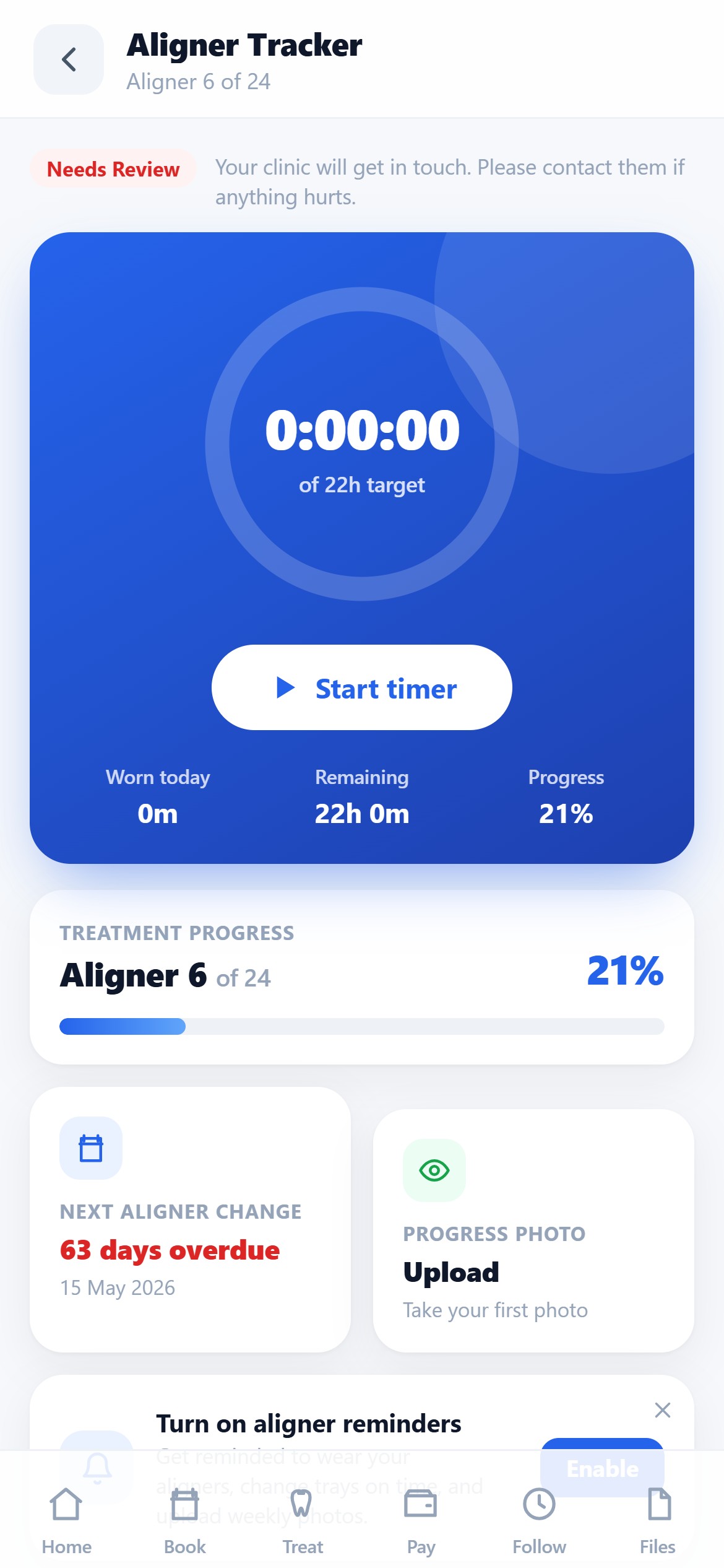 The aligner tracker with wear timer and progress